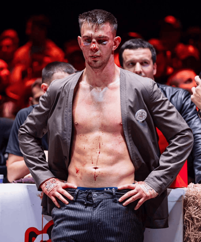 The Deputy TopDogs Bare Knuckle Fighting In Russia. 